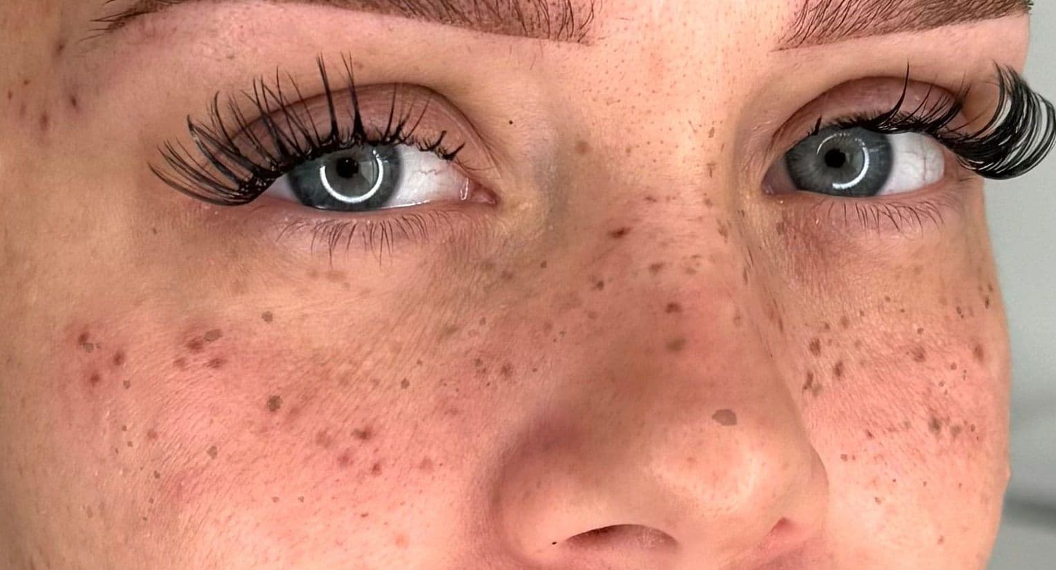 Dermopigmentation du visage pour créer des taches de rousseur naturelles et parsemées sur peau claire, une prestation esthétique signée par la formatrice Habiba Med.