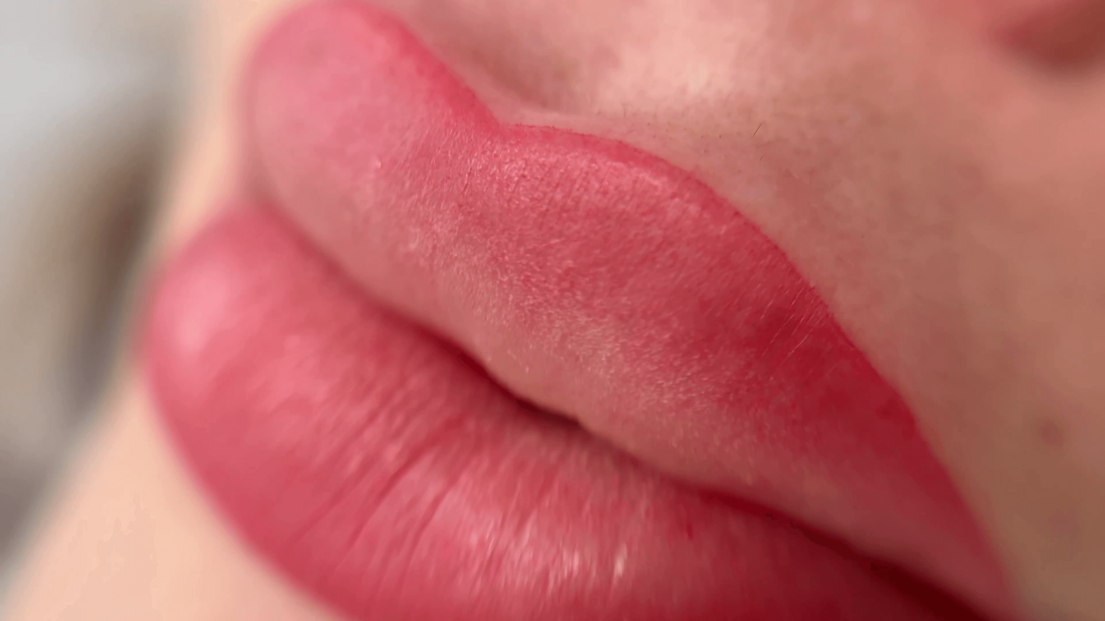 Démonstration visuelle de la pigmentation Candy Lips : des lèvres sublimées par une couleur intense et une symétrie parfaite. Démonstration visuelle de la pigmentation Candy Lips : des lèvres sublimées par une couleur intense et une symétrie parfaite.