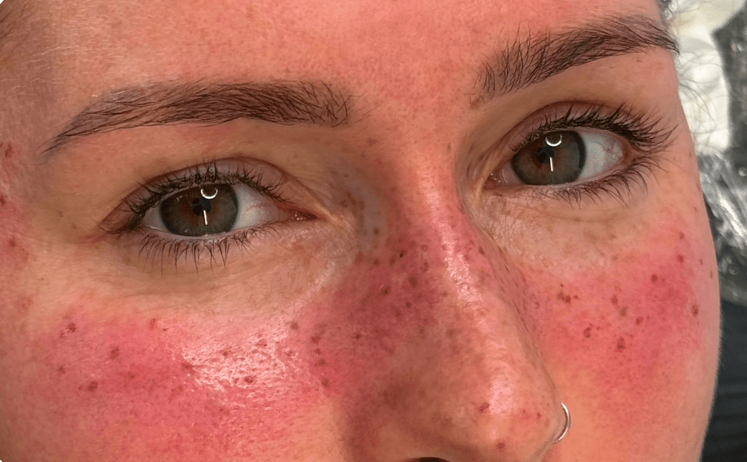 Tatouage permanent de faux freckles (taches de rousseur) sur peau très claire, avec des pigments marron clair pour un rendu naturel et dispersé sur le nez et les joues par Habiba Med.